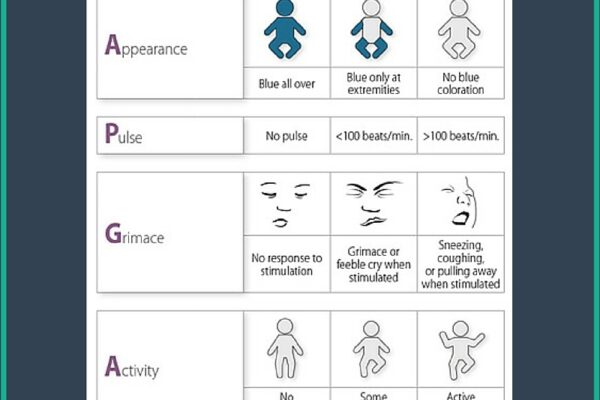 Apgar Scoring Table Mnemonic