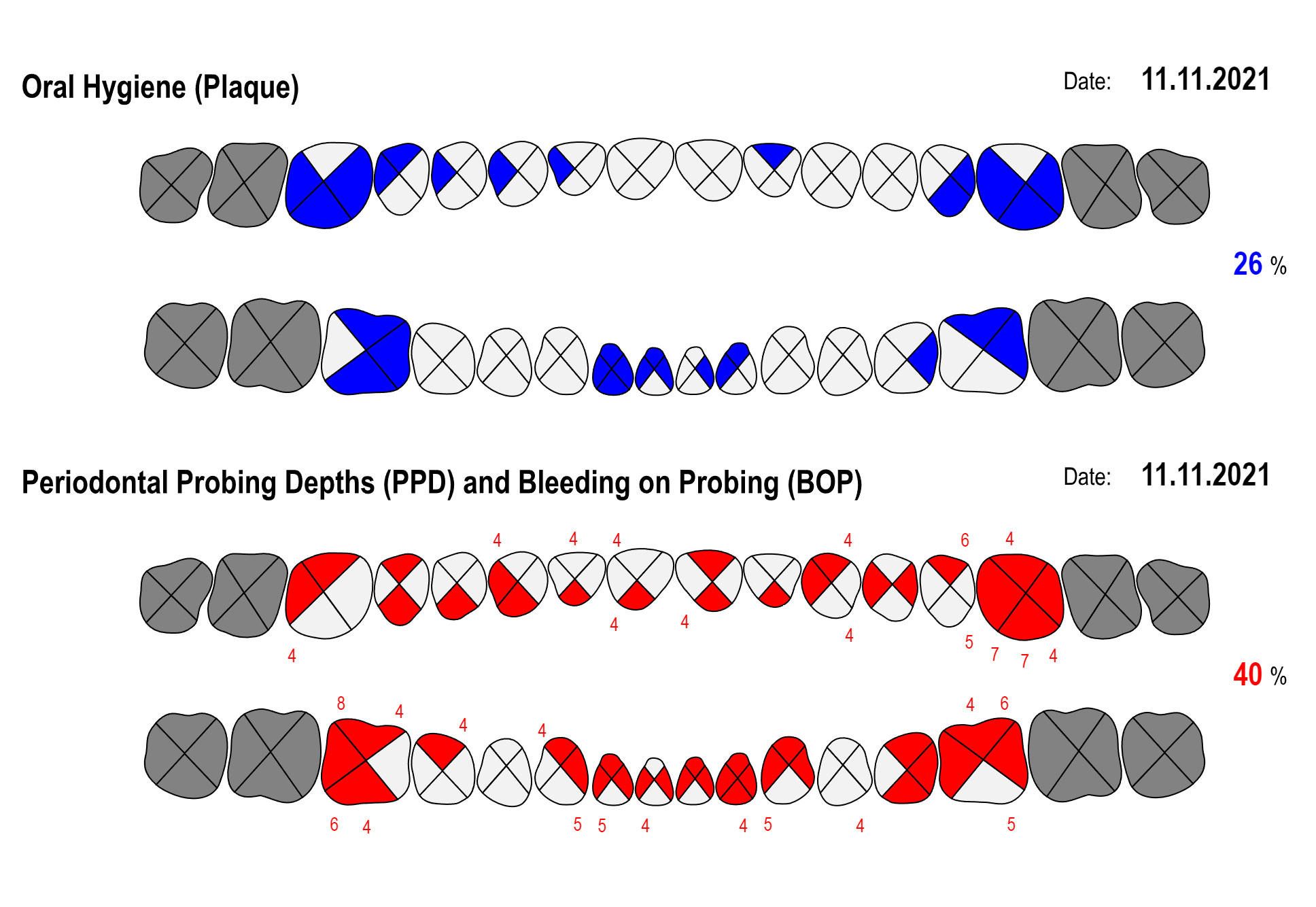 Printable Periodontal Probing Chart