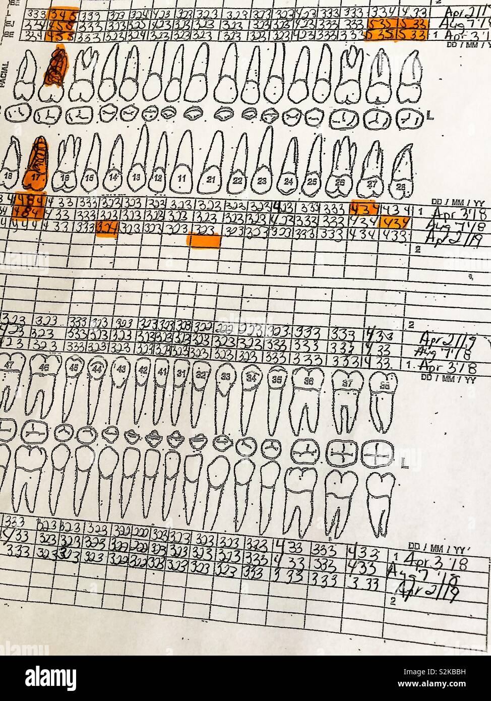 Printable Perio Chart