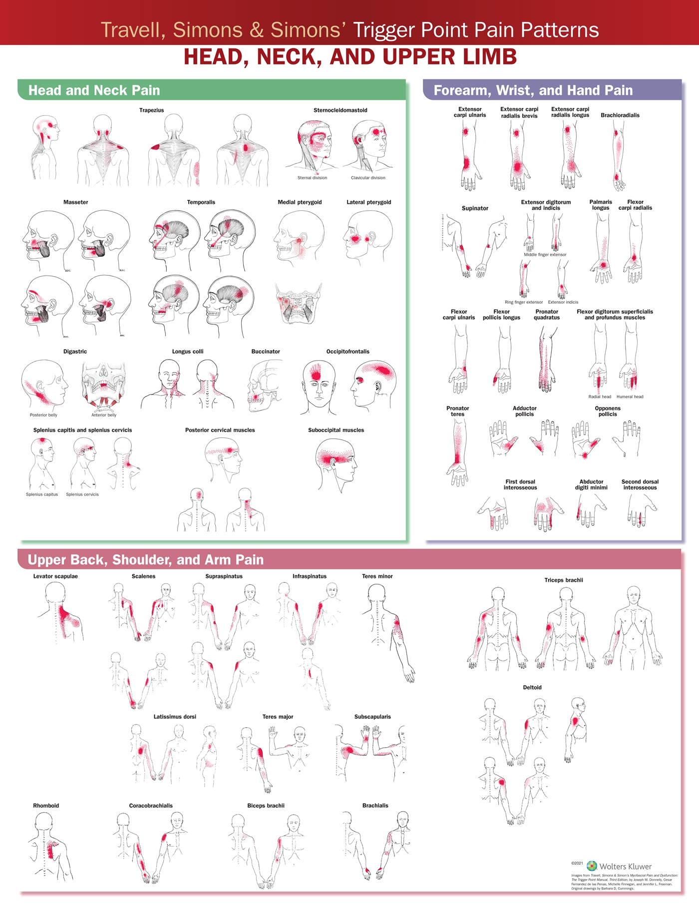 Travell Simons U0026 Simons Trigger Point Pain Patterns Wall Chart Head Neck And Upper Limb Soft Laminate Australian Physiotherapy Equipment