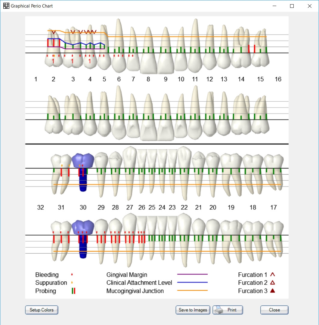 Dental And Perio Charts Dental And Perio Charts