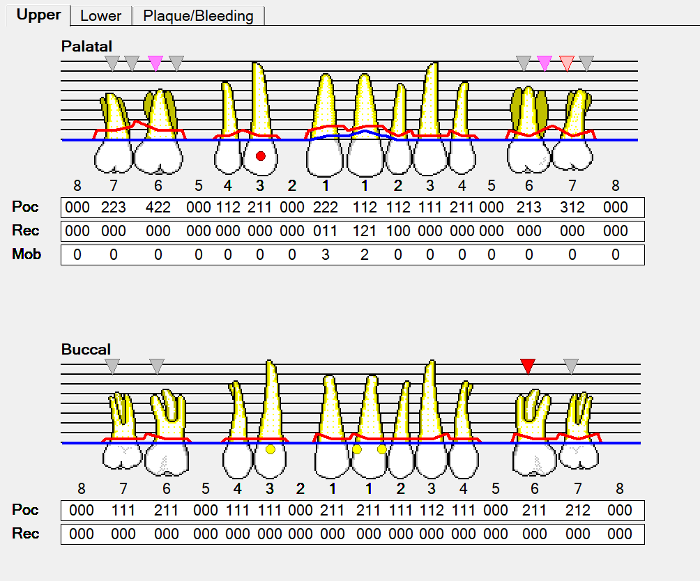 Printable Dental Perio Chart