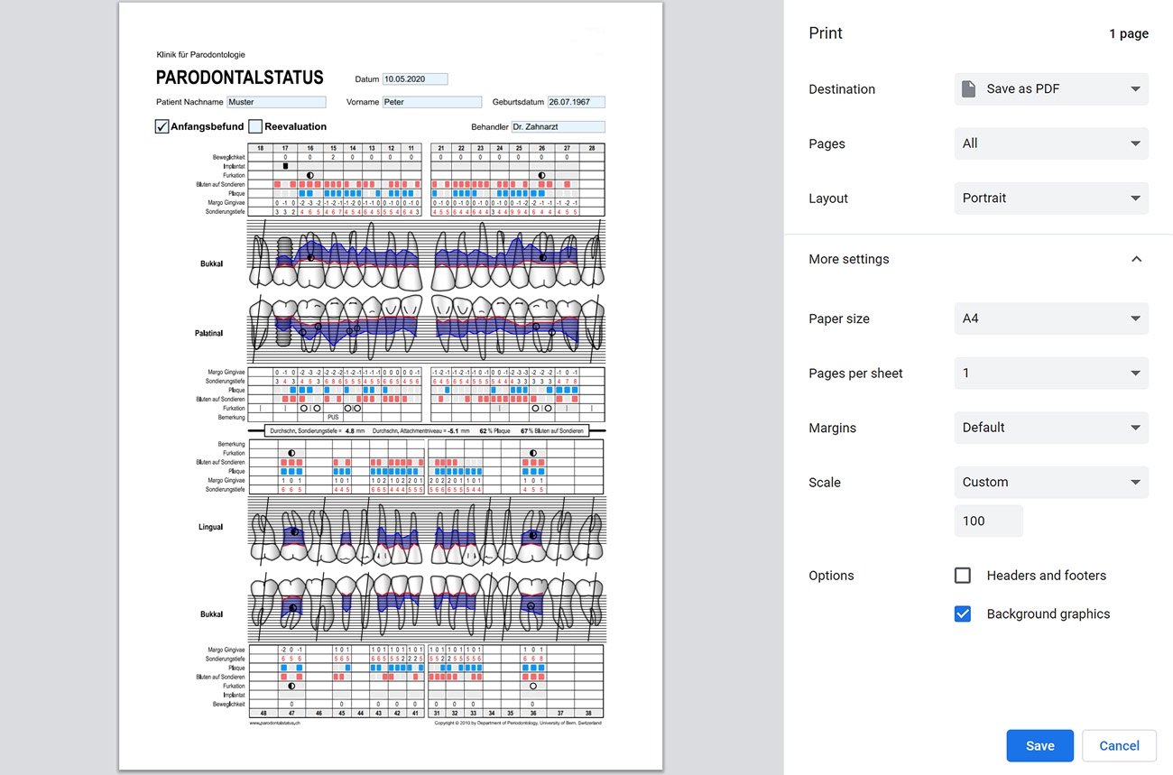 Periodontal Chart Online Www perio tools Periodontal Chart Online Www perio tools