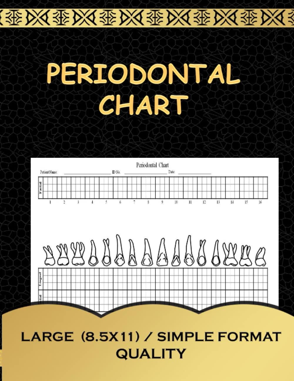 Periodontal Chart This Periodontal Chart Allows Dentists To Mark Irregularities On All 32 Teeth For Adult Patients Including The Facial And Lingual Periodontal Chart This Periodontal Chart Allows Dentists To Mark Irregularities On All 32 Teeth For Adult Patients Including The Facial And Lingual