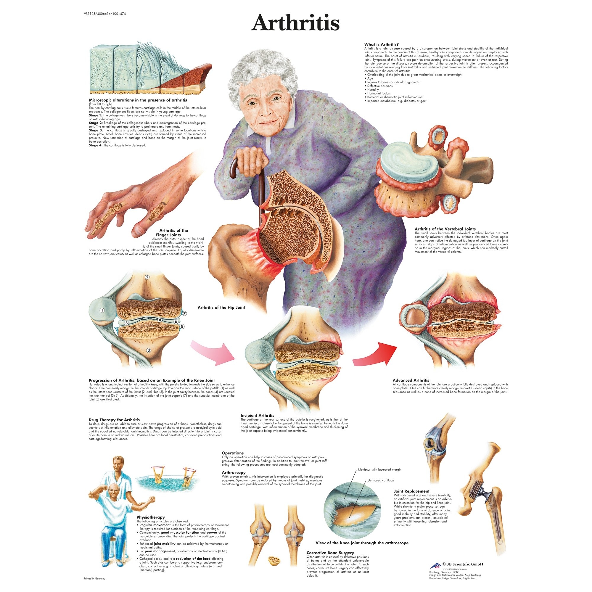 Free Printable Rheumatoid Arthritis Charts