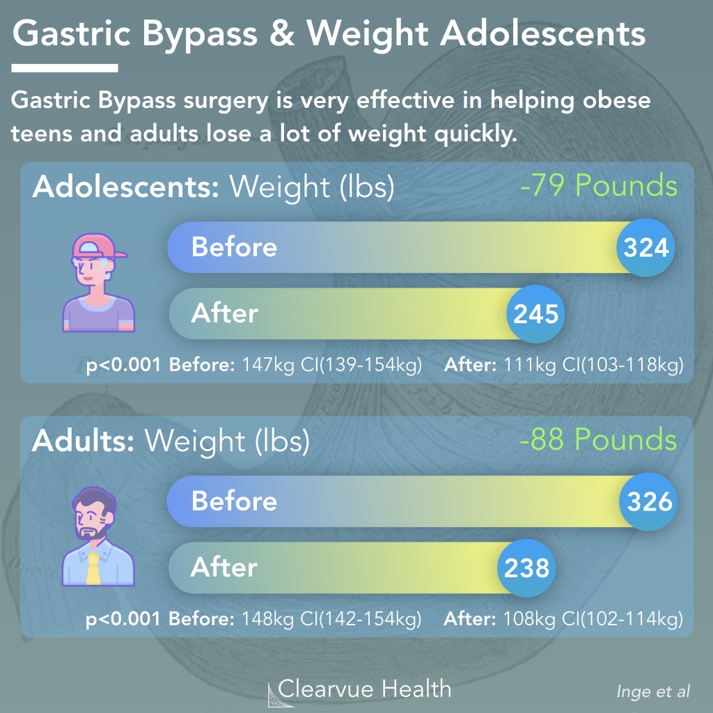 4 Charts Gastric Bypass Effectiveness In Adults Teens Visualized Science