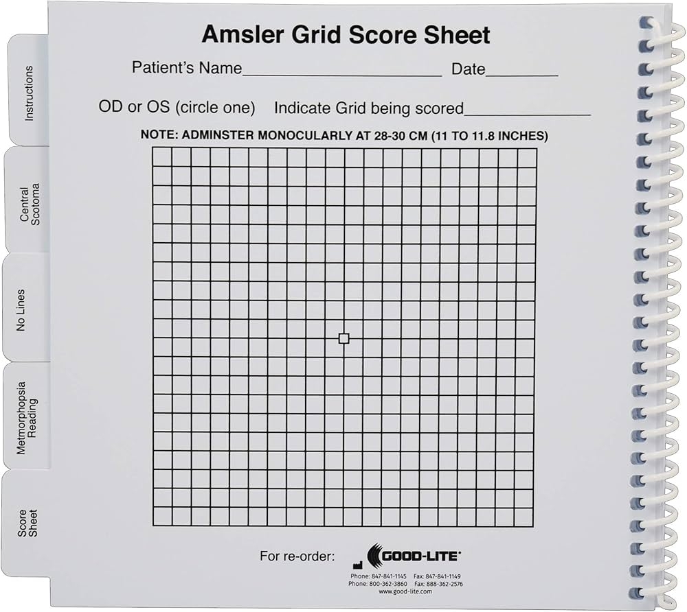 Amsler Grid Chart Printable Amsler Grid Chart Printable
