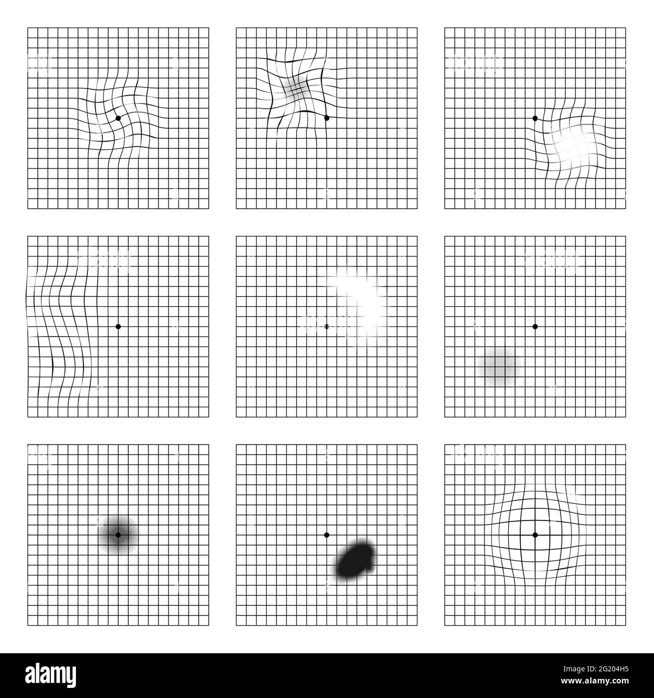 Amsler Eye Test Grid Oculist Vector Printable Chart Retina Examination Grid With Dot In Centre Vision Control Stock Vector Image Art Alamy Amsler Eye Test Grid Oculist Vector Printable Chart Retina Examination Grid With Dot In Centre Vision Control Stock Vector Image Art Alamy