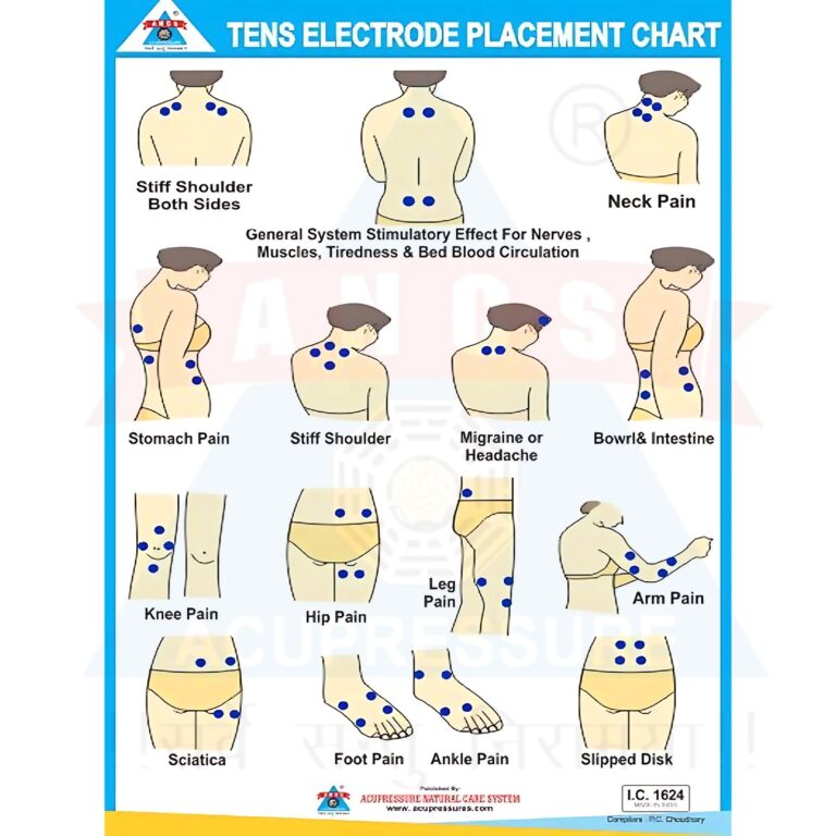 ANCS TENS Electrode Placement Chart ANCS Acupressure