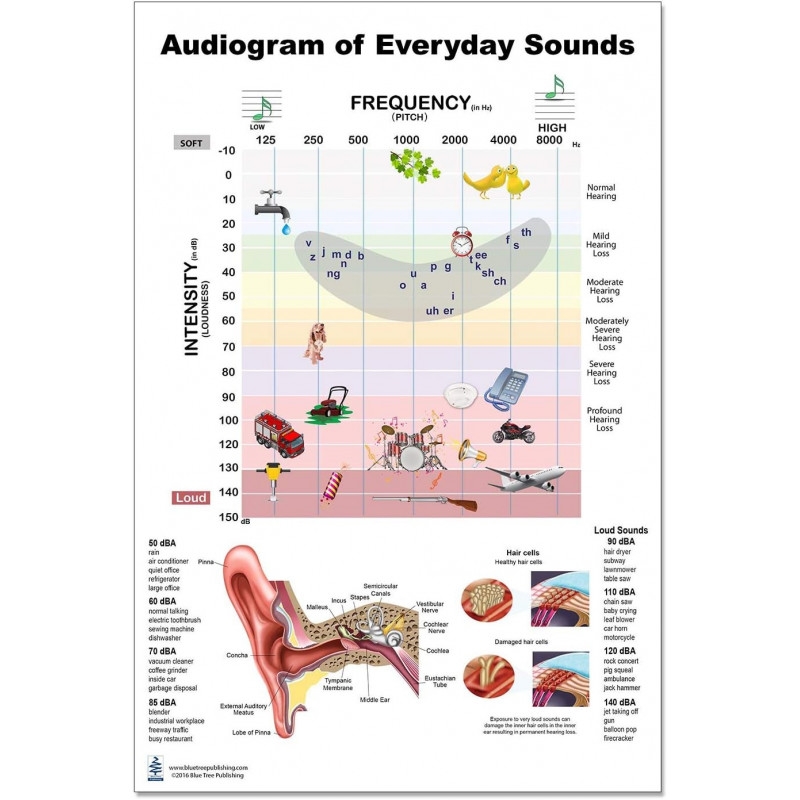 Audiogram Of Everyday Sound Large Poster Speech Banana Frequency Pitch And Ear Information Audiogram Of Everyday Sound Large Poster Speech Banana Frequency Pitch And Ear Information