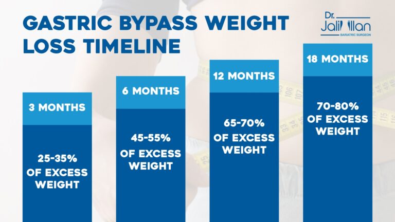 Gastric Bypass Surgery Weight Loss Timeline What To Expect Post Surgery