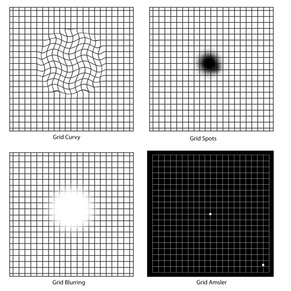 Macular Degeneration Grid Check Your Vision With An Amsler Grid Macular Degeneration Grid Check Your Vision With An Amsler Grid