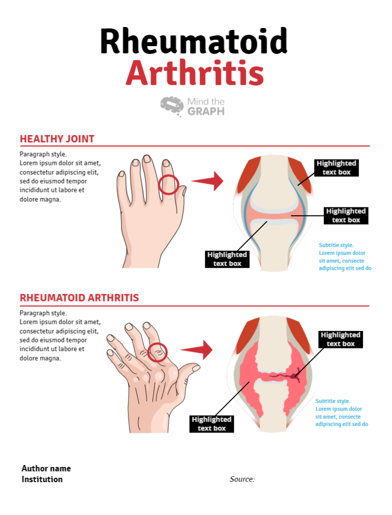 Rheumatoid Arthritis Infographic Templates