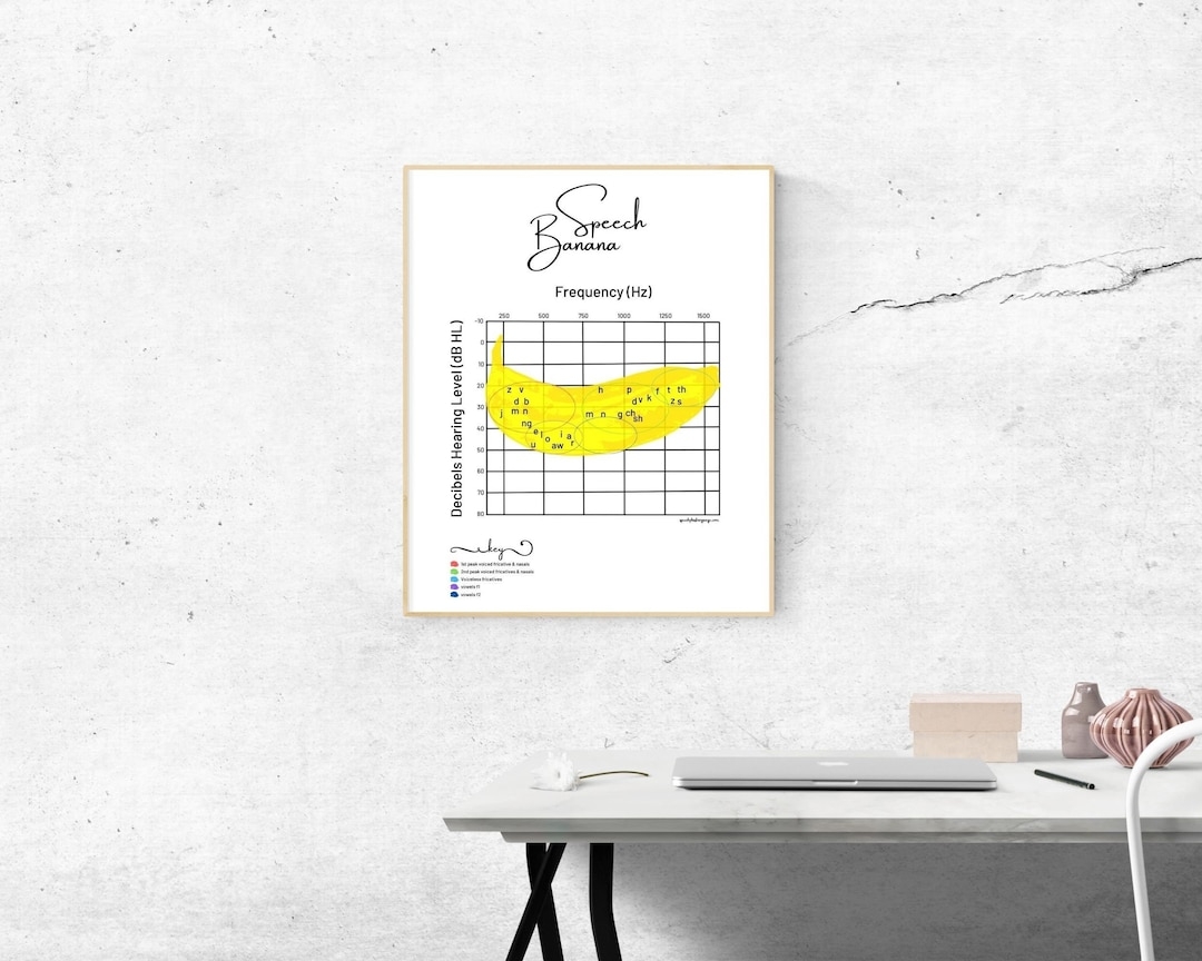 Speech Banana Audiogram Poster Audiology SLP Patient Education digital Download Etsy Speech Banana Audiogram Poster Audiology SLP Patient Education digital Download Etsy