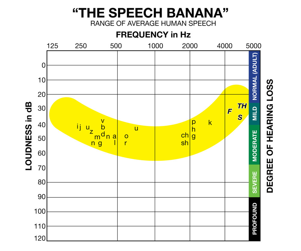 Speech Banana Wikipedia Speech Banana Wikipedia