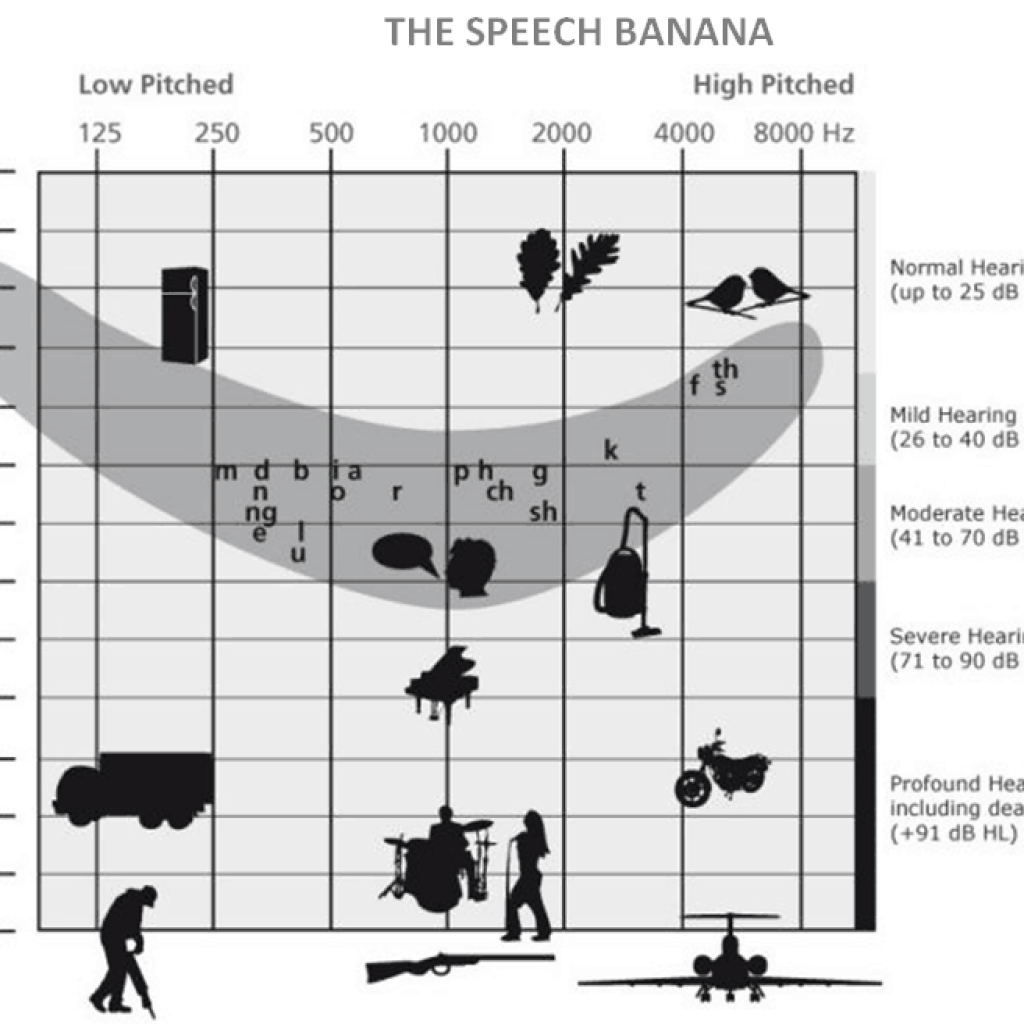 THE SPEECH BANANA Hearing Loss Support DEAFNABLE Is There To Help THE SPEECH BANANA Hearing Loss Support DEAFNABLE Is There To Help