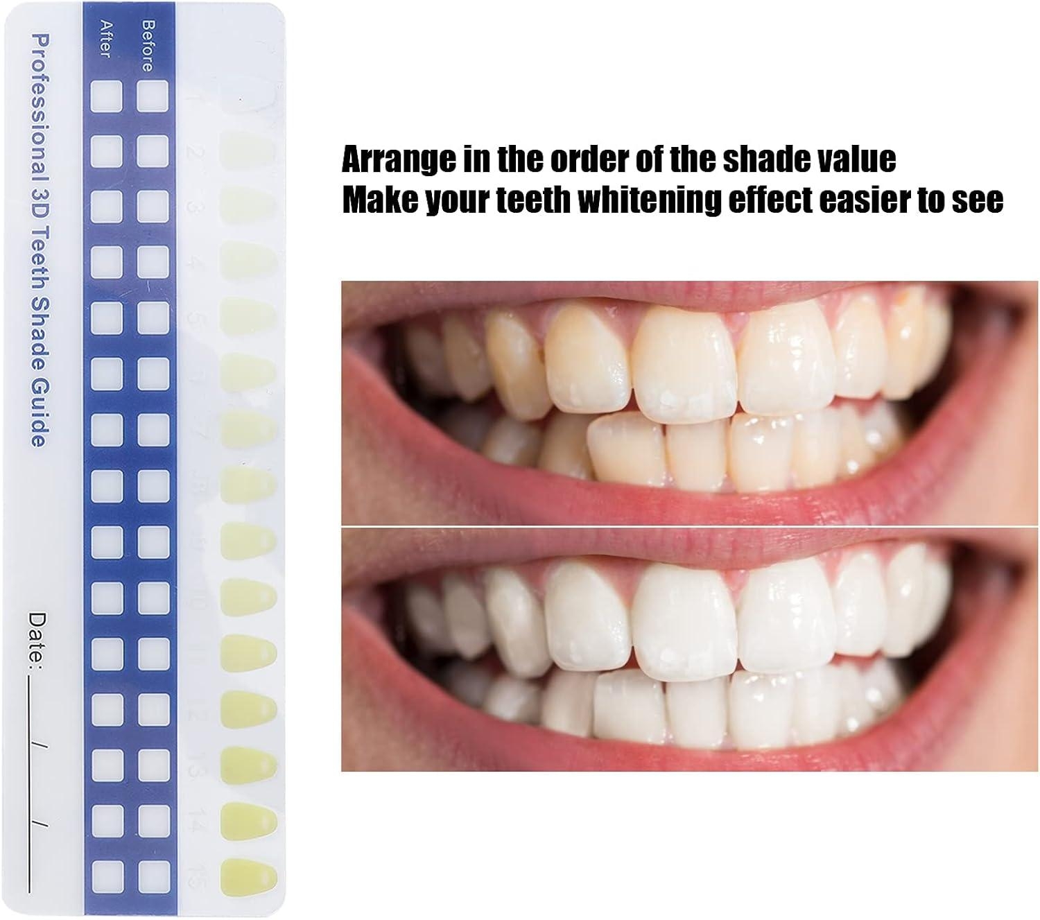 Teeth Whitening Chart Printable