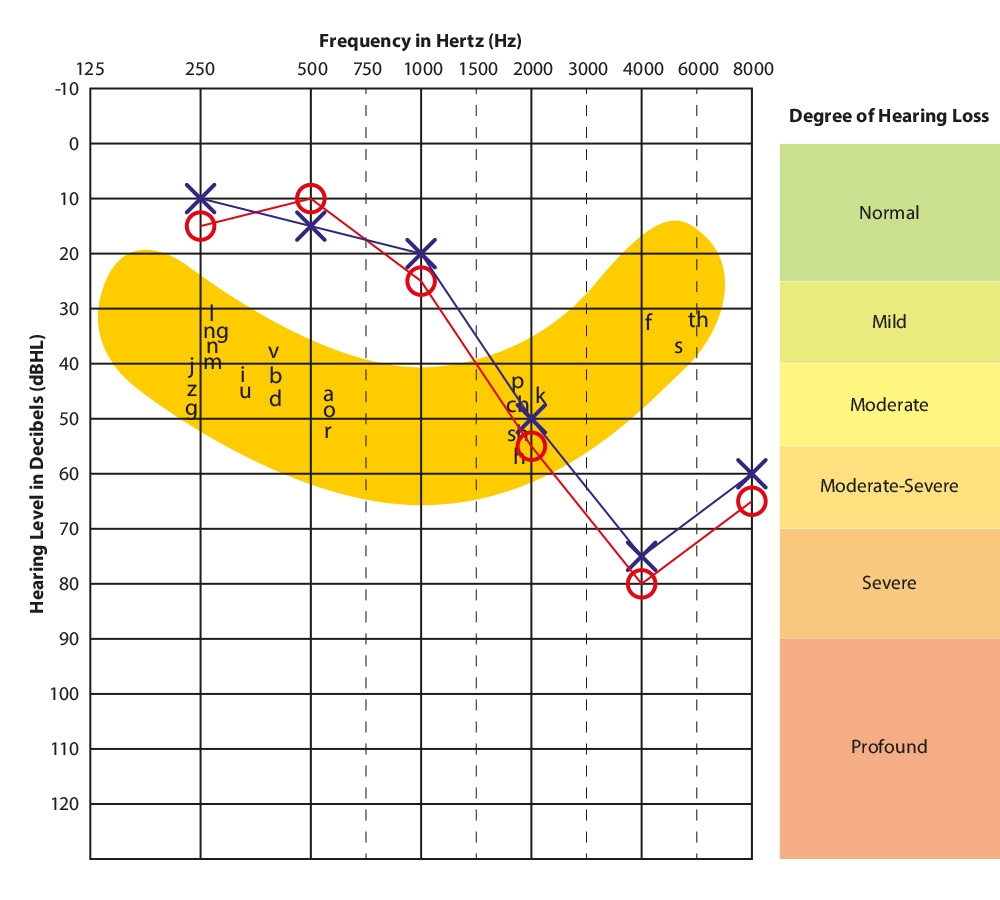 What Is A Speech Banana What Is A Speech Banana